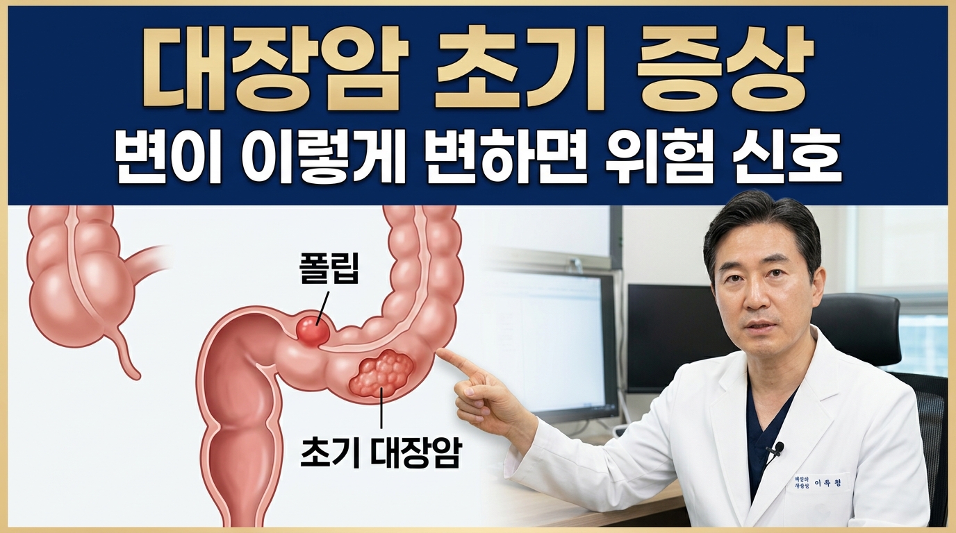 대장암 초기 증상 4가지 배변 습관 변화 및 가는 변 혈변 자가진단 가이드